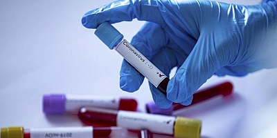 Boğularak ölen kişinin cesedine 41 günde yapılan 28 Kovid-19 testi pozitif çıktı