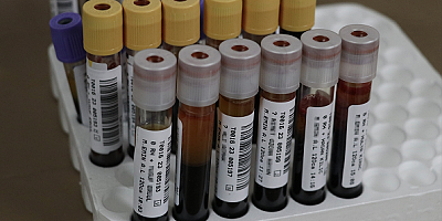 Kanser hastası çocuklar için okullarda kök hücre bağışlanıyor