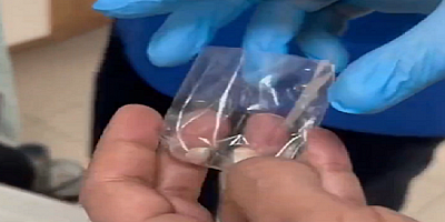 Kayseri'de kulağının içinde uyuşturucu madde saklayan şahıs yakalandı