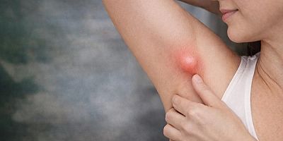 Koltuk Altındaki Şişlik Her Zaman Masum Değil: Ektopik Meme Dokusu Uyarısı