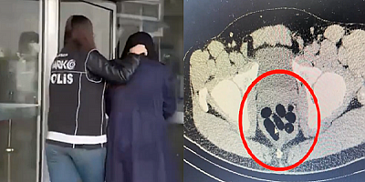 Uyuşturucuyu midesinde taşıdı Kayseri'de yakalandı!